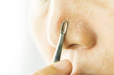 Blackhead Removing